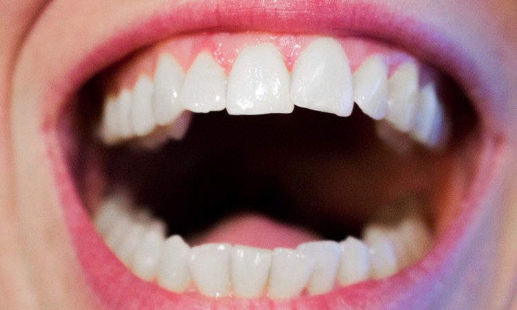 teeth-1652937_1280