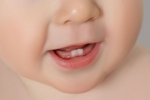 34747524 - close-up baby mouth with two rises teeth